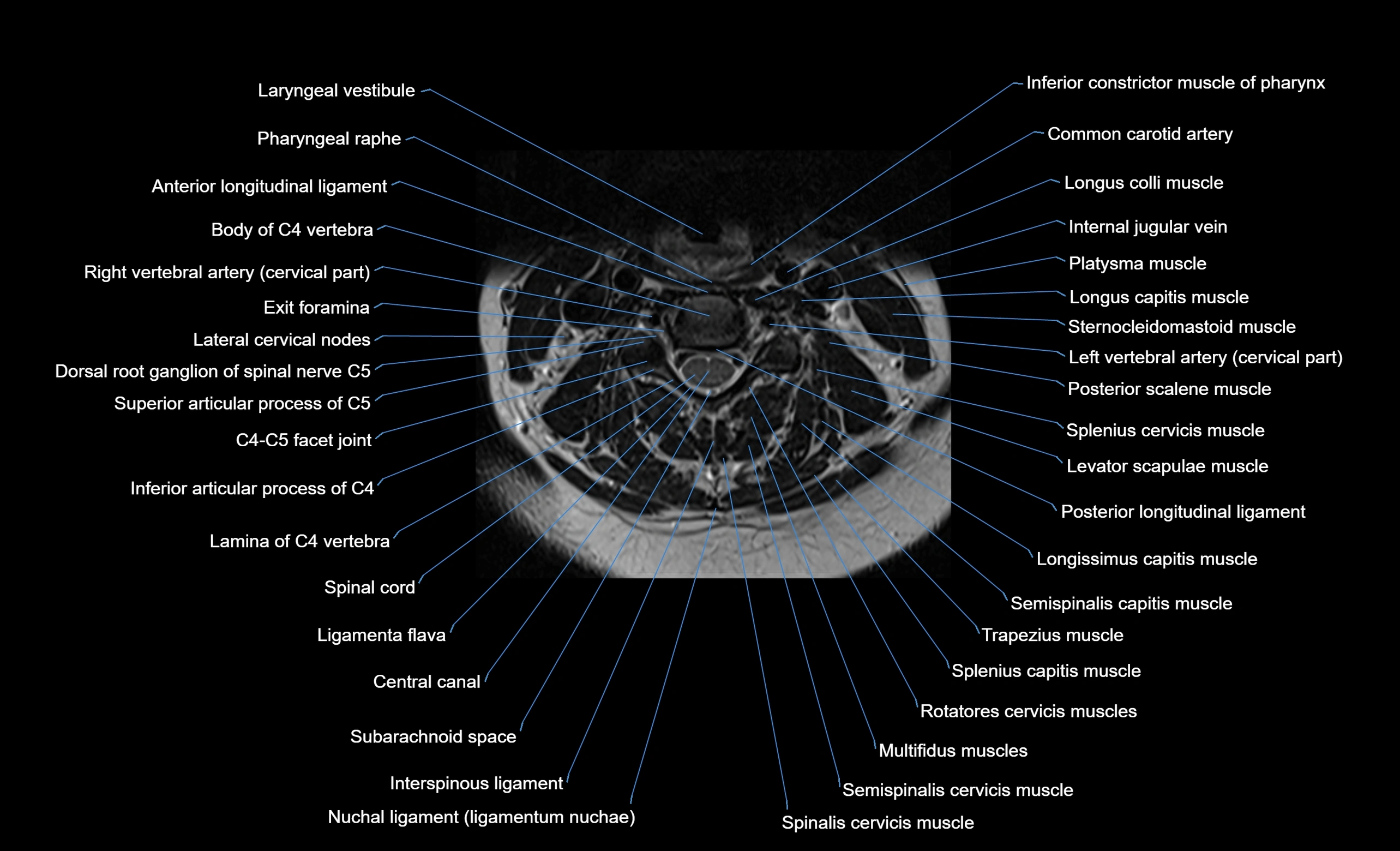cervical spine cross sectional MRI anatomy  3T MRI axial  image-img-00001-00023.webp